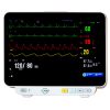 Screen touch patient monitor